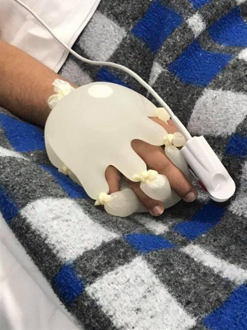 Enfermeira brasileira cria técnica da mãozinha para confortar pacientes