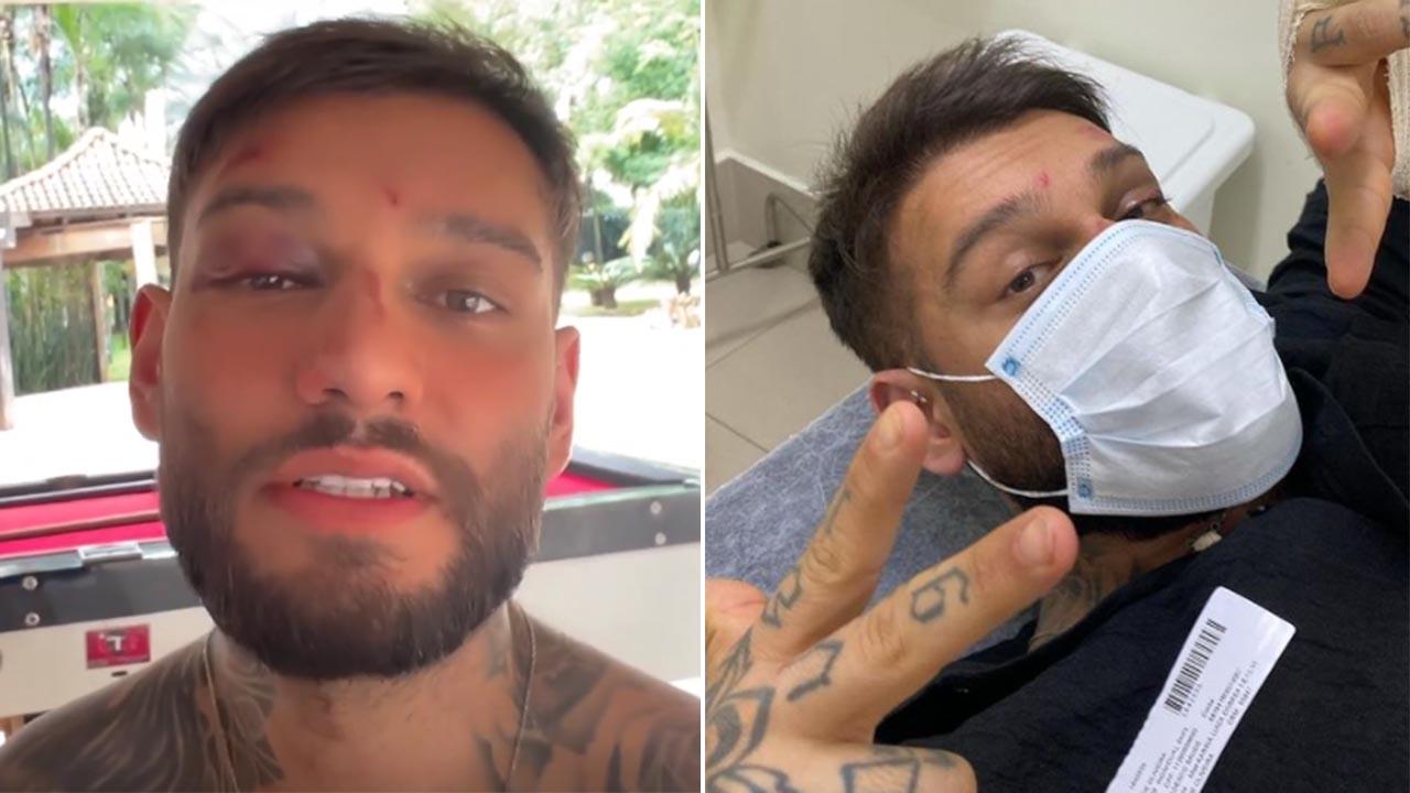Após acidente doméstico, cantor Lucas Lucco vai parar em hospital