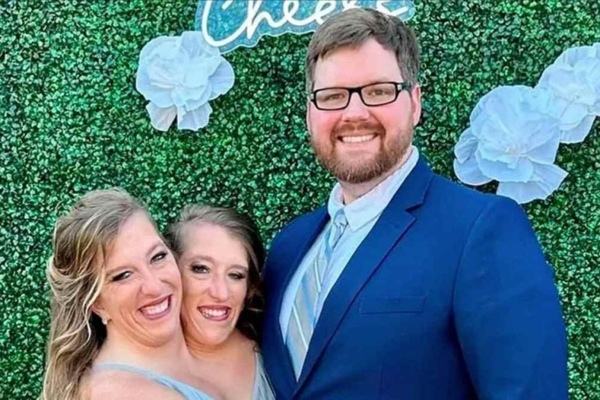 Abby Hensel, do Reality "Abby & Brittany", Revela Casamento com Josh Bowling